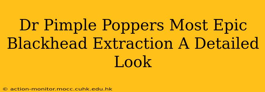 Dr Pimple Poppers Most Epic Blackhead Extraction A Detailed Look