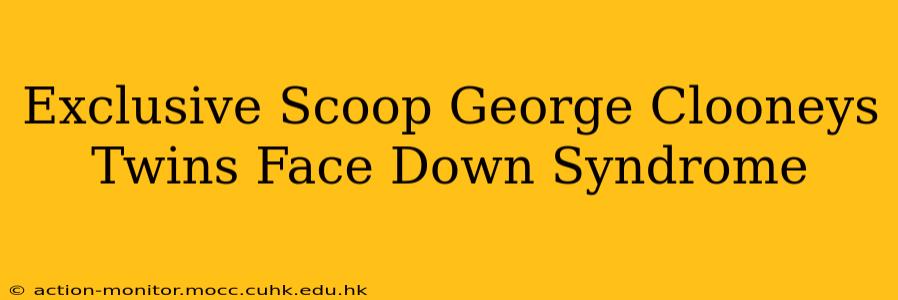 Exclusive Scoop George Clooneys Twins Face Down Syndrome