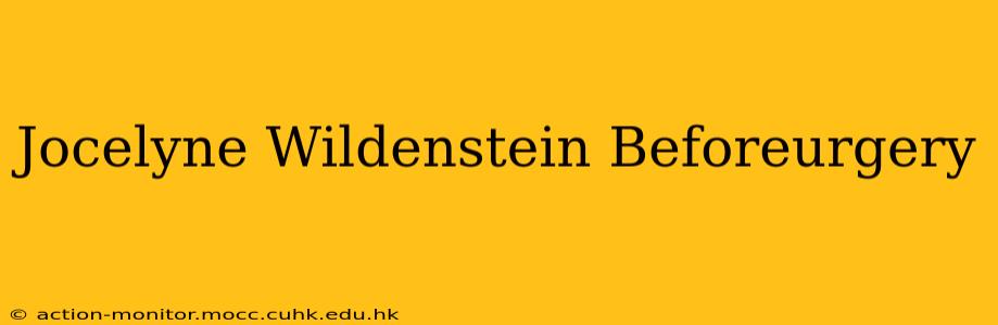 Jocelyne Wildenstein Beforeurgery
