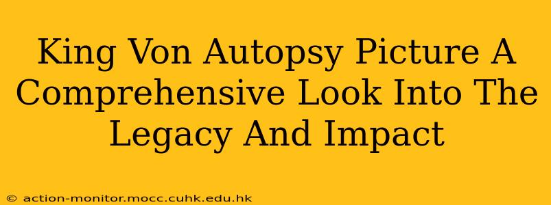 King Von Autopsy Picture A Comprehensive Look Into The Legacy And Impact