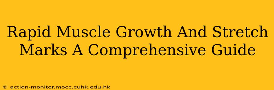 Rapid Muscle Growth And Stretch Marks A Comprehensive Guide