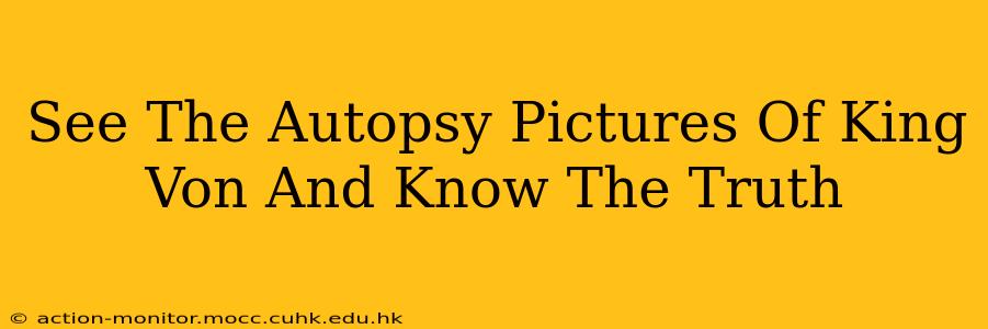 See The Autopsy Pictures Of King Von And Know The Truth