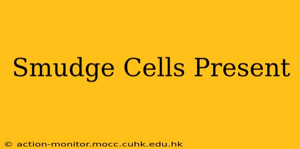 Smudge Cells Present
