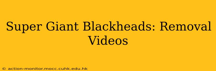 Super Giant Blackheads: Removal Videos