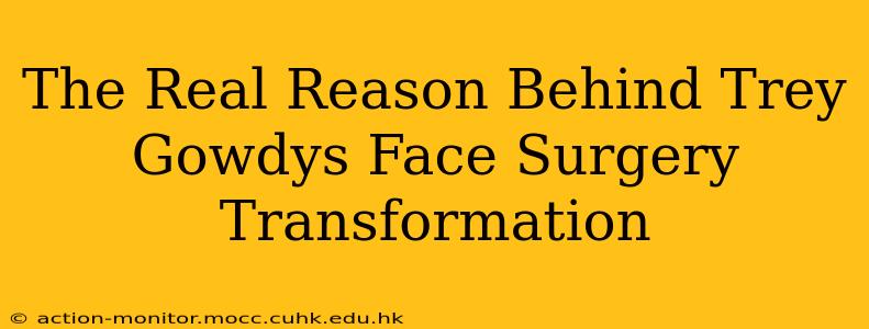 The Real Reason Behind Trey Gowdys Face Surgery Transformation