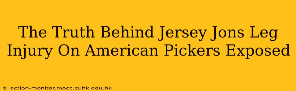 The Truth Behind Jersey Jons Leg Injury On American Pickers Exposed