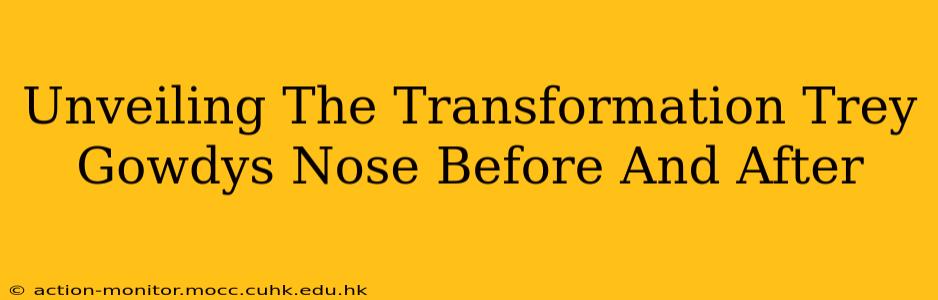 Unveiling The Transformation Trey Gowdys Nose Before And After