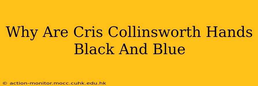 Why Are Cris Collinsworth Hands Black And Blue